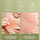 Pologmase Multi Balm Stick Centella Hydrating Facial Moisturizer for Dry Skin view 4