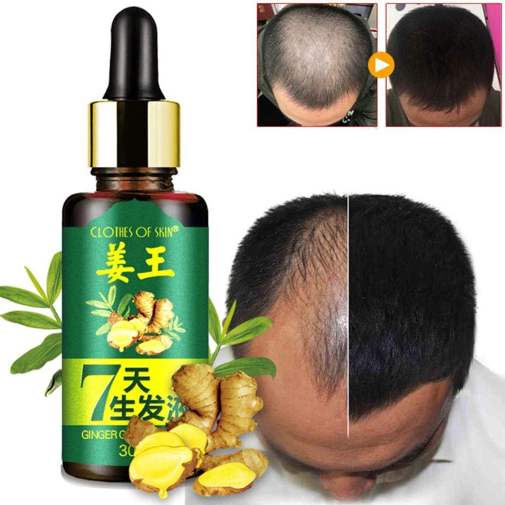XEDUO Hair Growth Essence liquid Ginger Fast Hair Growth Natural Hair Loss Treatment (Ginger)