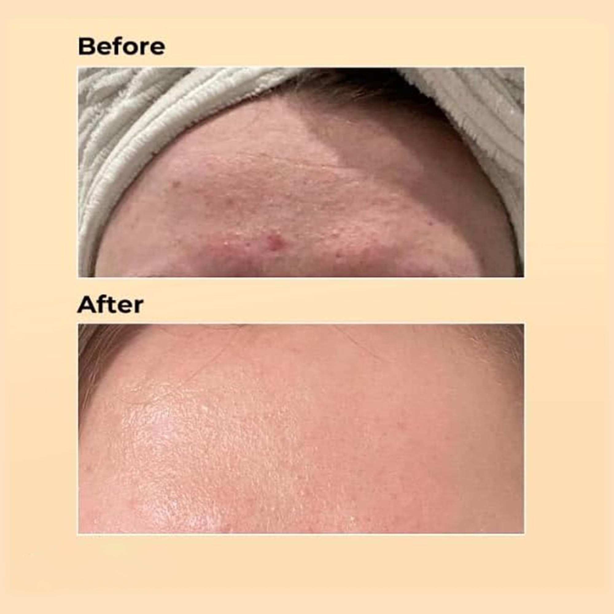 COSINGKIN Advanced Snail Mucin 96% Power Repairing Essence, Serum, Hydrating Serum For Face With Secretion Filtrate Dull And Damaged Skin, Anti-Aging & Discoloration Correcting 100 ML