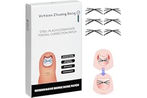 ingrown toenail treatment