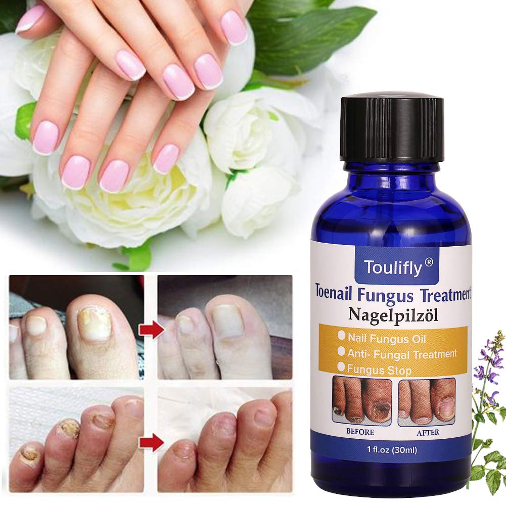 Nail Repair, Nail Solution, Natural Nail Treatment, Effective Against Nail Infection Restores Discolored & Damaged Nails : Beauty