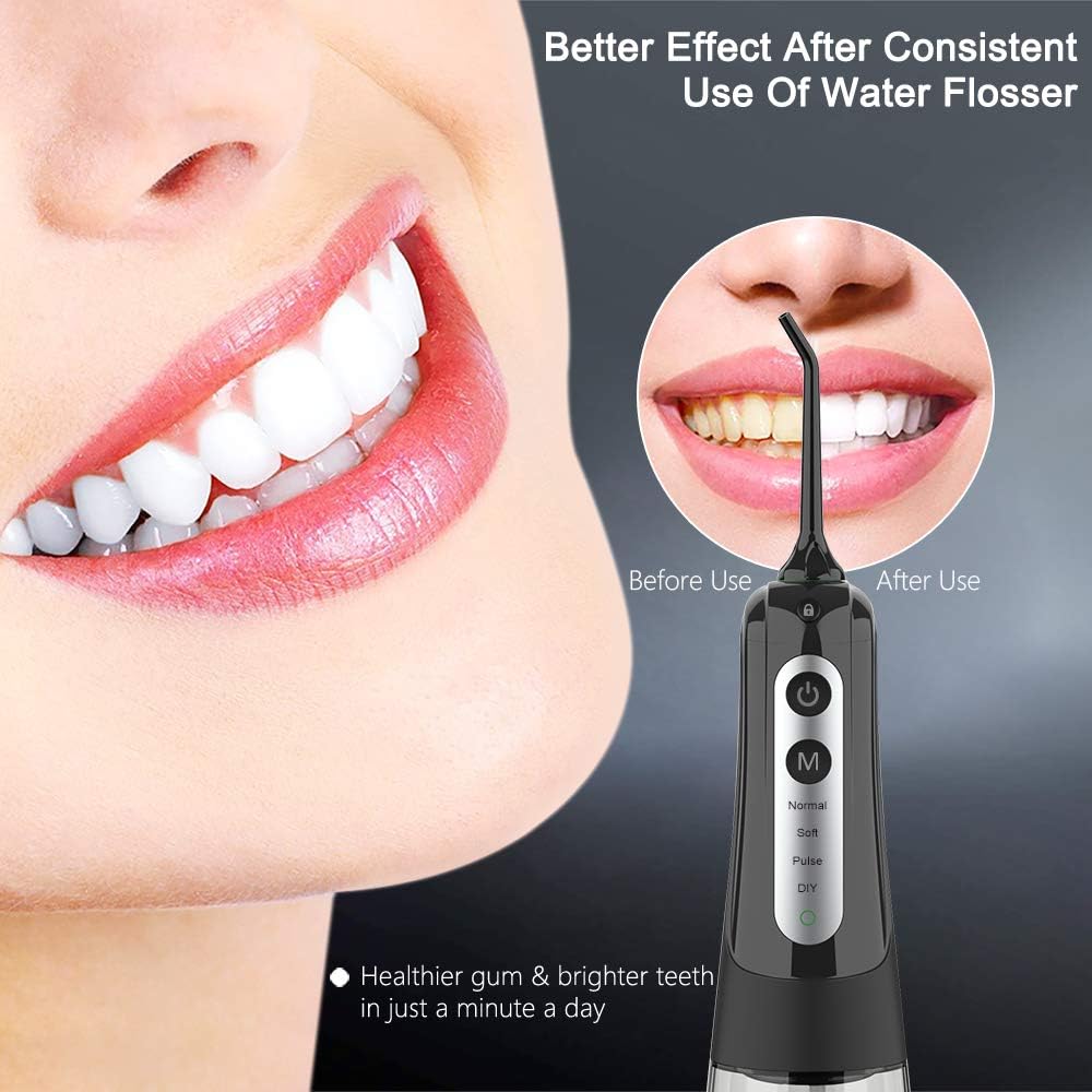 Cordless Water Flosser Teeth Cleaner, INSMART Professional 300ML Tank DIY Mode USB Rechargable Dental Oral Irrigator for Home and Travel, IPX7 Waterproof 3 Modes Water Flosser for Oral Care: Health & Personal Care