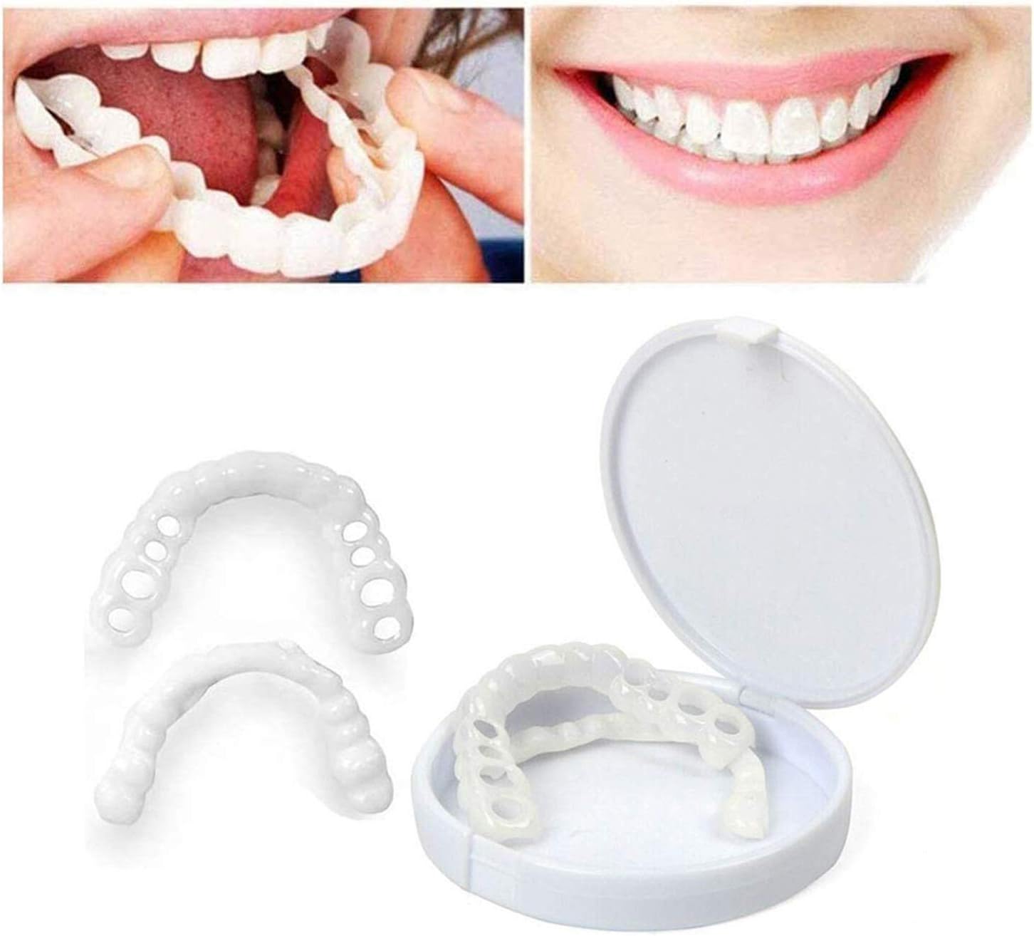 2 Pairs Top Teeth Veneers for Teaching, Fake Teeth Braces for Temporary