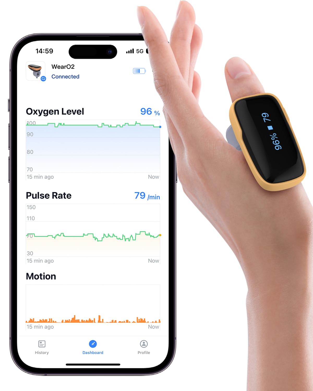 Viatom WearO2 Wearable Pulse Oximeter, Bluetooth Oxygen Monitor for Continuous O2 and Heart Rate, Rechargeable Blood Oxygen Monitor with Vibration Alarm with Free APP