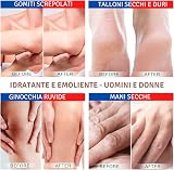 TIS farmaceutic Urea 15% Cream for Eczema, Psoriasis, Dry Rough Skin view 3