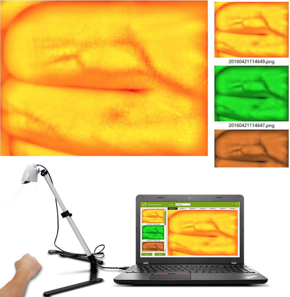 LUCKYYAN Infrared Vein Finder Viewer Display Imaging,Medical Adjustable Vein Finder for Adult Children Hands Feet Legs Vein Finder
