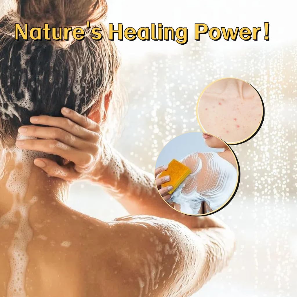 Kojic Acid & Turmeric Soap Bar for Dark Spot removal - Skin Lightening Soap with Vitamin C, Retinol, Shea Butter & Lemon Oil - for Face, Body, Underarms - SLS Free, for Oily & Dry Skin