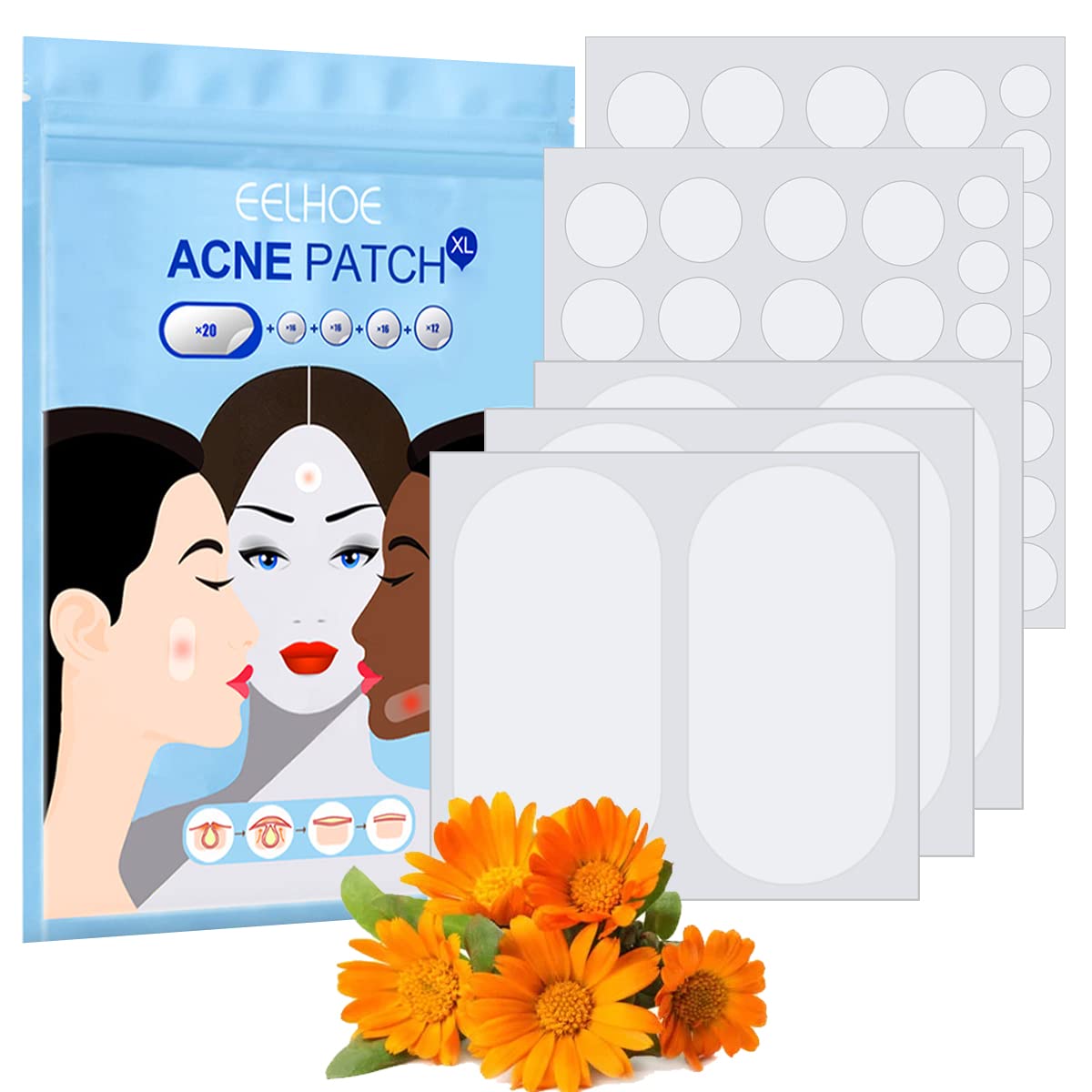 80Pcs Acne Patch Pimple Patches Hydrocolloid Patches Tea Tree Oil for Large Zit Breakouts, Acne Patches for Face Chin or Body, Invisible Spot Patches, 5 Sizes 8mm,10mm,12mm,14mm,60mm