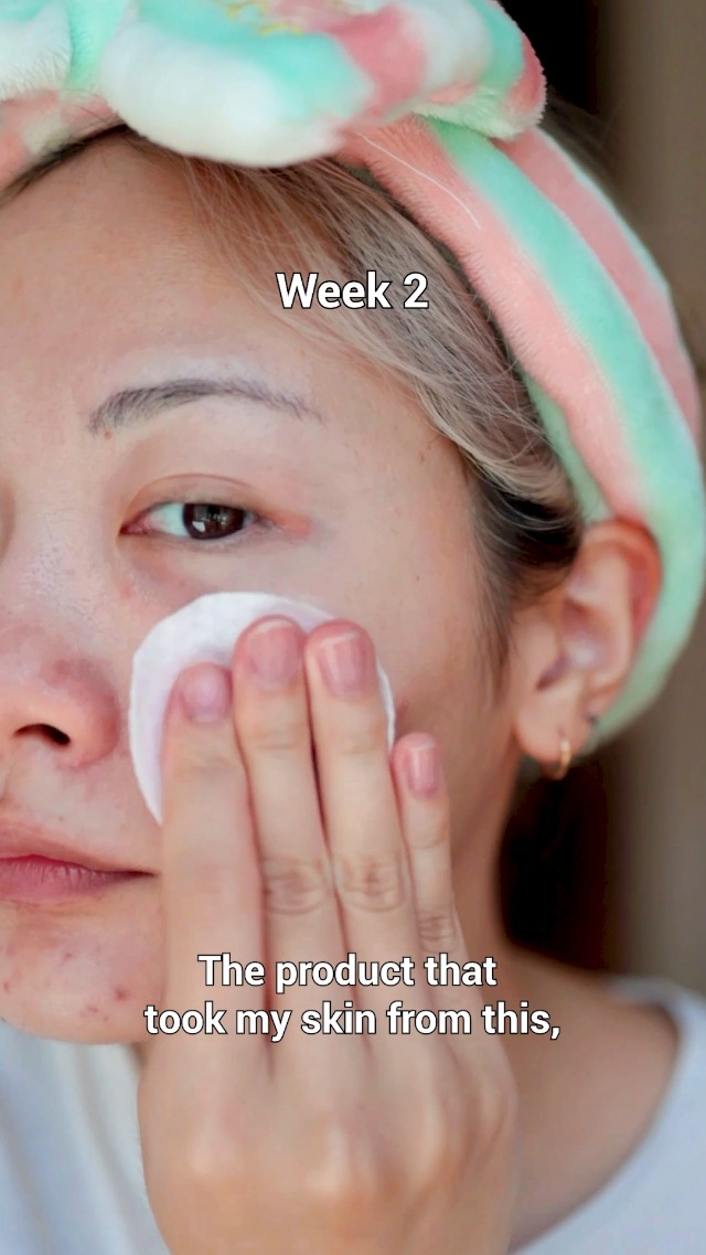 Thumbnail 23