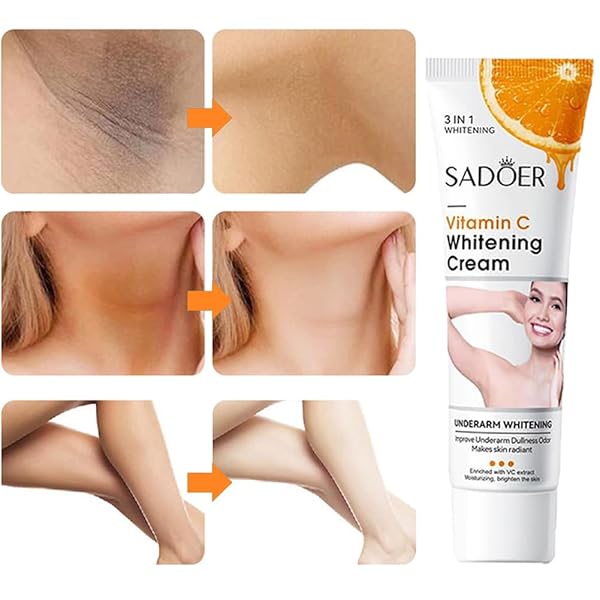 SKIN WHITENING CREAM FOR BODY,LIGHTENING CREAM FOR INTIMATE AREAS AND BLEACHING,VITAMIN C DARK SPOT REMOVER CORRECTOR FOR NECK,ARMPIT,UNDERARM,ELBOW,INNER THIGH AND KNEES,BIKINI,1.76OZ