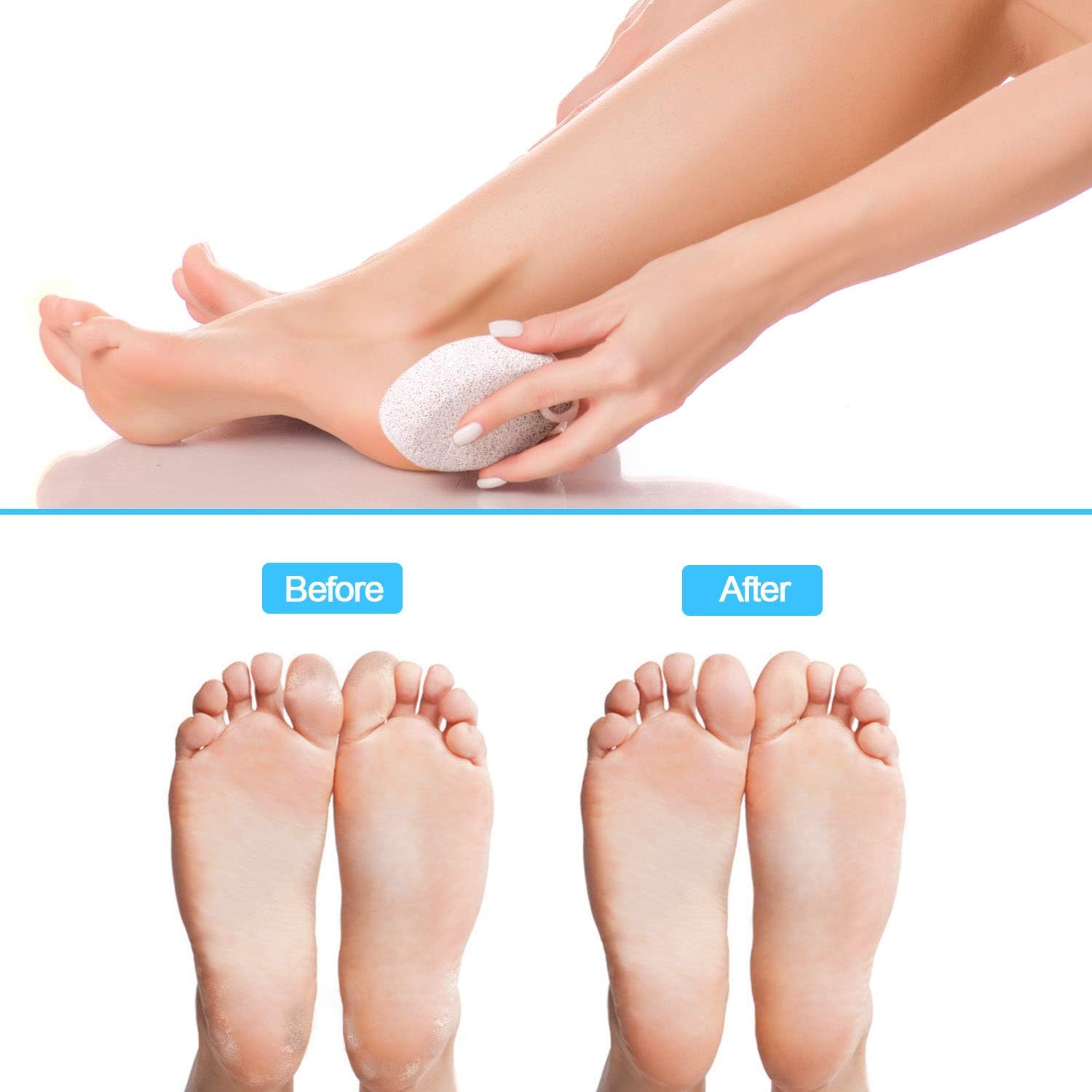 EAONE 4 Pack Pumice Stone, Premium Callus Remover Pumice Stone Pedicure Tools Hard Skin Callus Remover Natural Foot File Scrubber for Exfoliation to Remove Dead Skin: Health & Personal Care