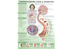 Understanding Type 2 Diabetes Anatomical Chart