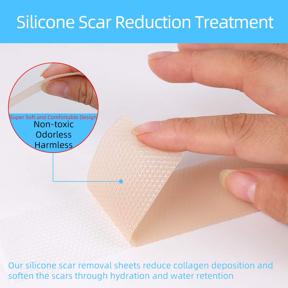 Professional Soft Silicone Scar Sheets, Prevents & Treats All Scars, Soften and Flattens Scars Resulting from C-section, Surgery, Injury, Burns, Acne, 5.9"×1.38", 5 Sheets(5 Months Supply)… : Beauty