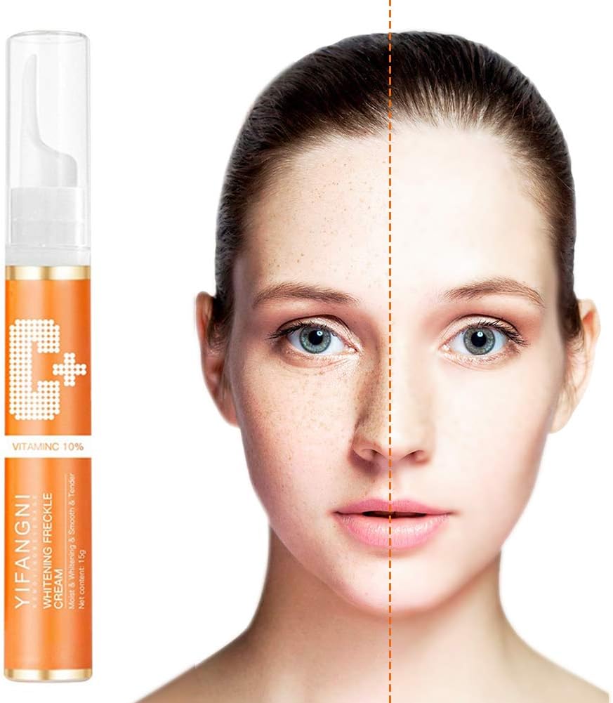 cream to get rid of freckles