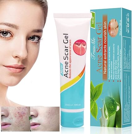 fast acne scar removal cream