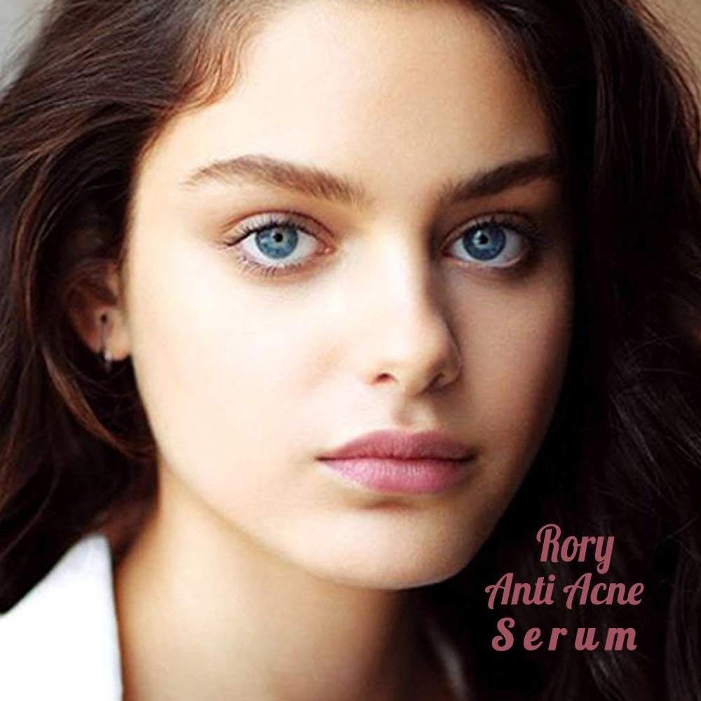 rory anti acne serum