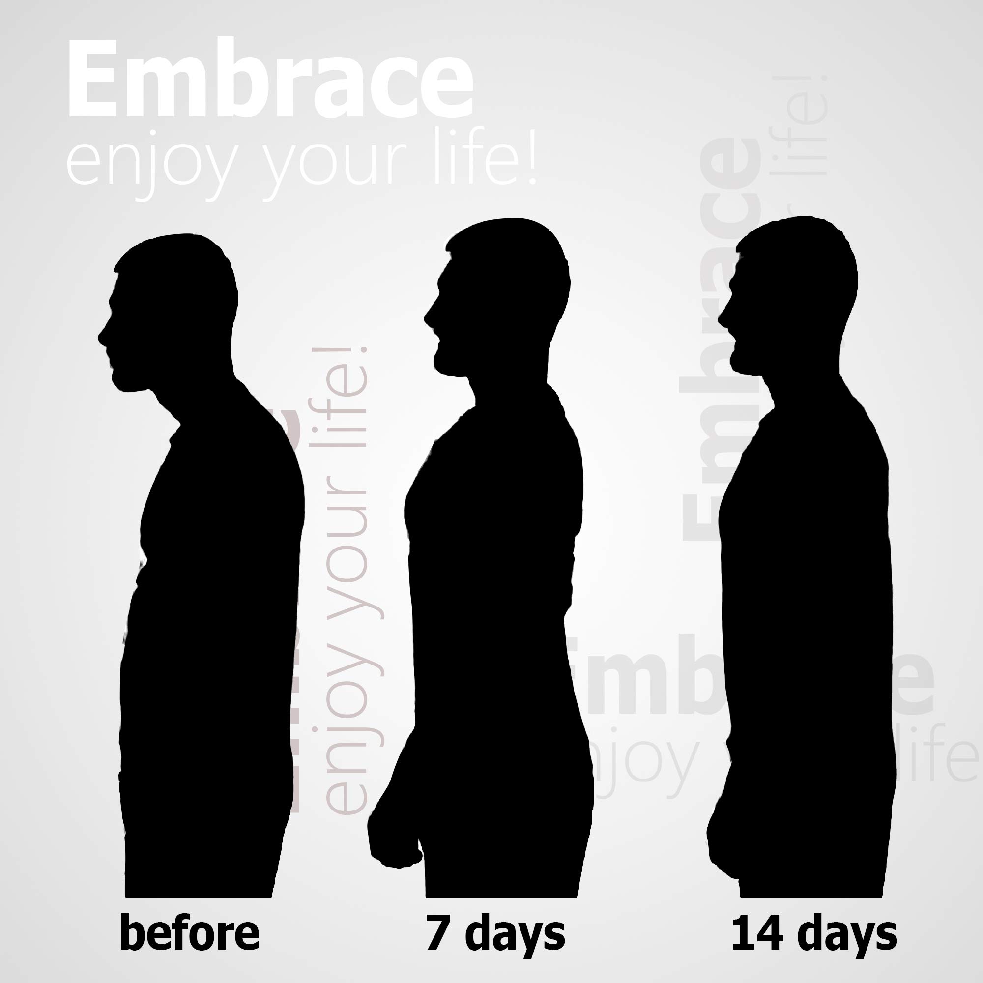 Back Support Posture Corrector for Women and Men,Adjustable Posture Corrector Back Brace Support Belt Lumbar Waist Shoulder Corset Spine Support Posture Correction (Normal)