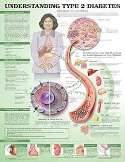 Understanding Sort 2 Diabetes Anatomical Chart