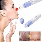 Electric Blackhead Remover Tool Luckyfine Portable Mini Facial Blackhead Remover Skin Cleansing Suction Tool Acne Oil Removal Tools Pore Extractor Face Massage Spot Cleaner Device