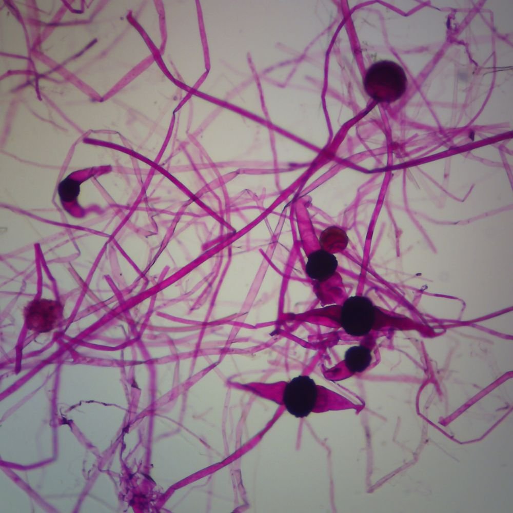 Buy Rhizopus Conjugation W M Microscope Slide Online At Low Prices In India Amazon In