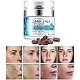 Dark Spot Remover for Face, Fast-Acting Dark Spot Corrector Remover for Face and body Hyperpigmentation, Fades Melasma, Freckle, Sun Spots, Evens Skin Tone, Age Spot Remover for Women Men
