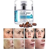 Dark Spot Remover for Face, Fast-Acting Dark Spot Corrector Remover for Face and body Hyperpigmentation, Fades Melasma, Freckle, Sun Spots, Evens Skin Tone, Age Spot Remover for Women Men