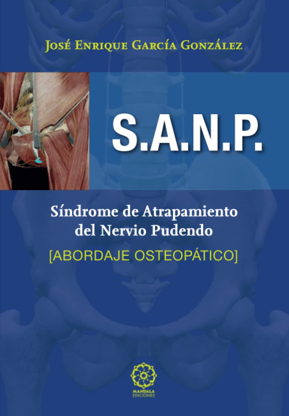 S.A.N.P. SÍNDROME DEL ATRAPAMIENTO DEL NERVIO PUDENDO