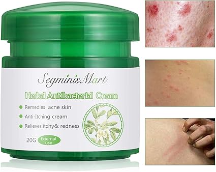 Justroa Ventas Crema De Enebro 96gr Para Que Sirve Facebook