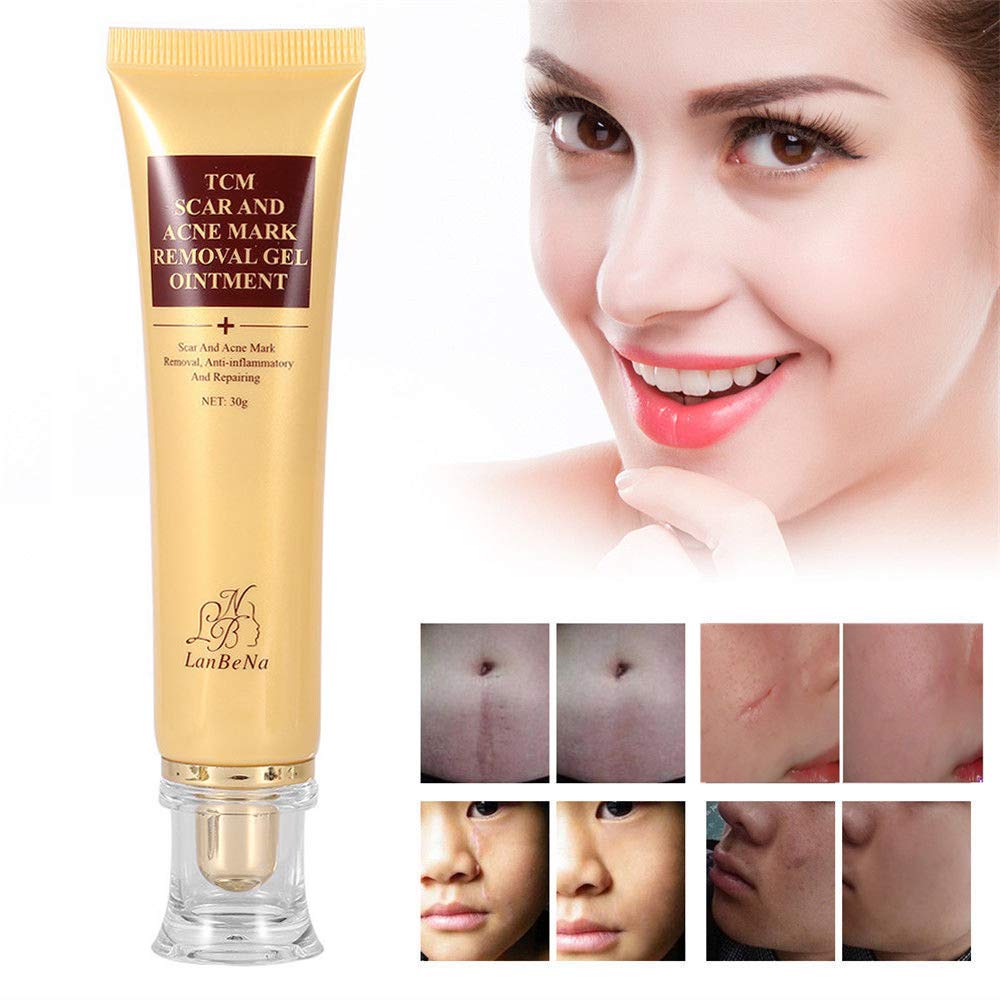 face stretch marks removal cream