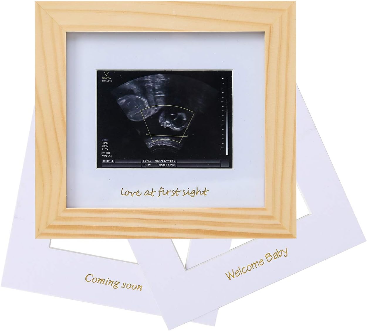 Baby Sonogram Photo Frame - 1st ultrasound picture frame - Idea Gift for Expecting Parents,Baby Shower, Gender Reveal…