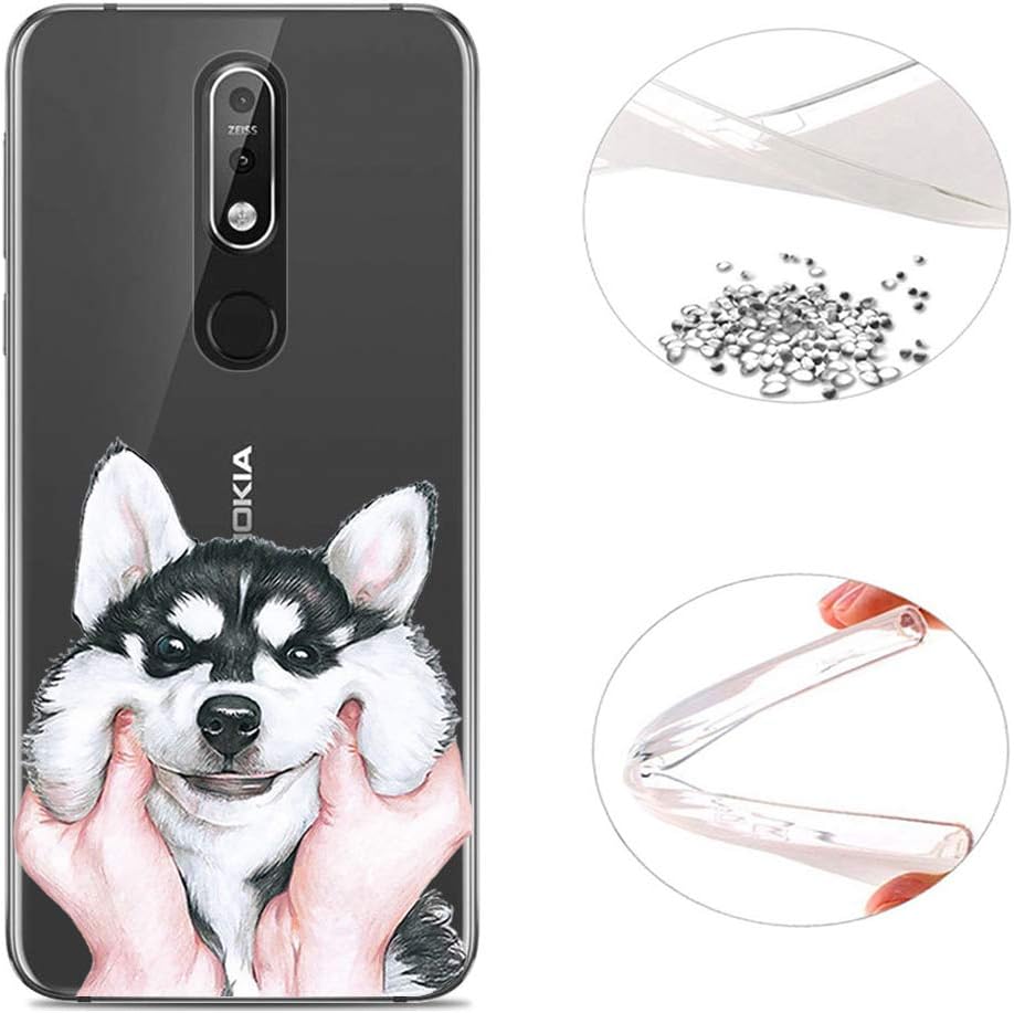Cover for Nokia 7.1 Plating Case Soft Gel Silicone TPU shockproof Anti-Scratch cover Phone Case for Nokia 7.1