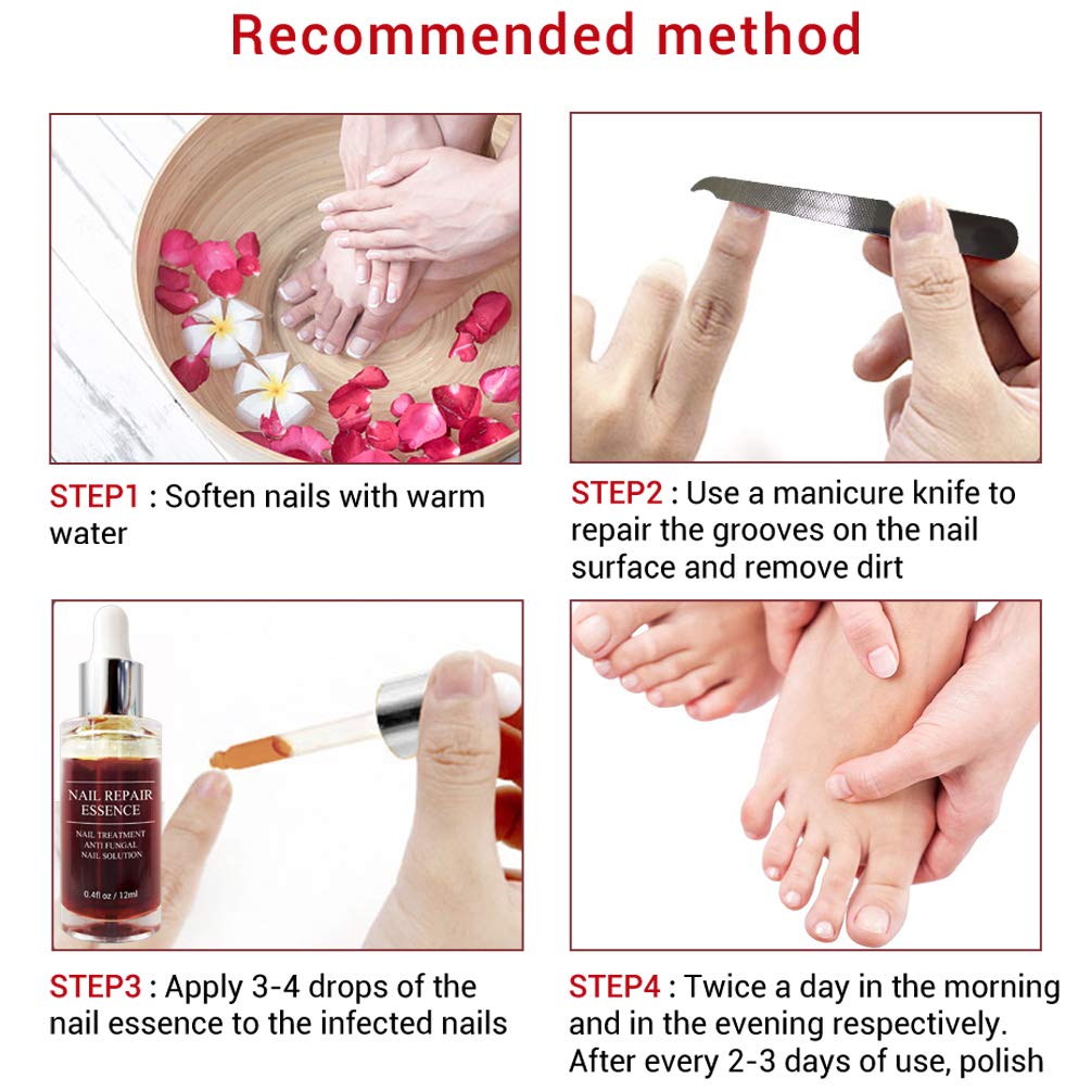 Fanmin Toenail and Nail Repair Essence, Remove Paronychia Onychomycosis Toe, Toenail and Nail Care Solution, Toenail and Nail Renewal, Fixes and Restores Discolored and Damaged Nails : Beauty
