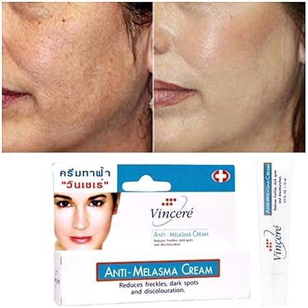 anti melasma cream