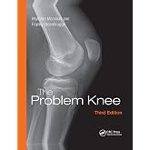 The Problem Knee