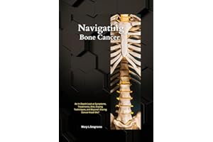 Navigating Bone Cancer: : An In-Depth Look at Symptoms, Treatments, Diet, Coping Techniques, and Beyond! (Facing Cancer Head-