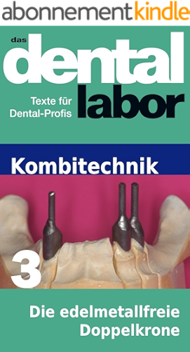 Download Die edelmetallfreie Doppelkrone (das dental labor Fachtexte 23) (German Edition) PDF