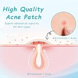 Azonelife 144 Hydrocolloid Acne Patches Face Spots Pimple Treatment Stickers view 2
