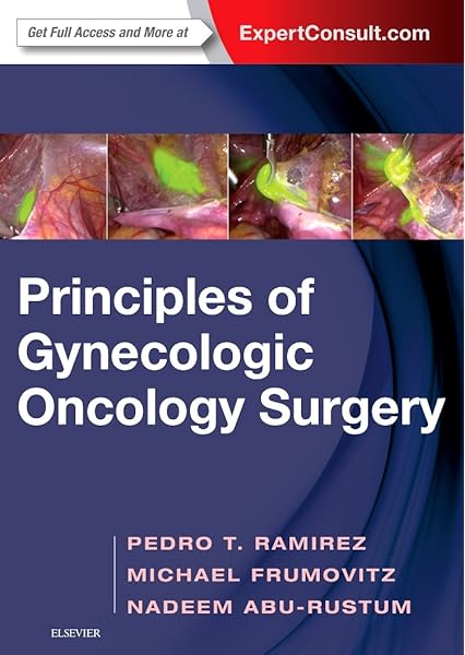 Principles Of Gynecologic Oncology Surgery 0000323428789 Medicine Health Science Books Amazon Com