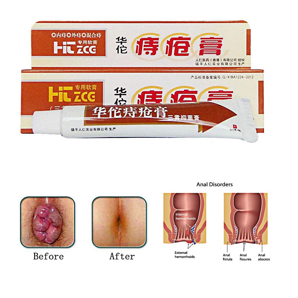 How To Apply Hemorrhoid Cream Internally