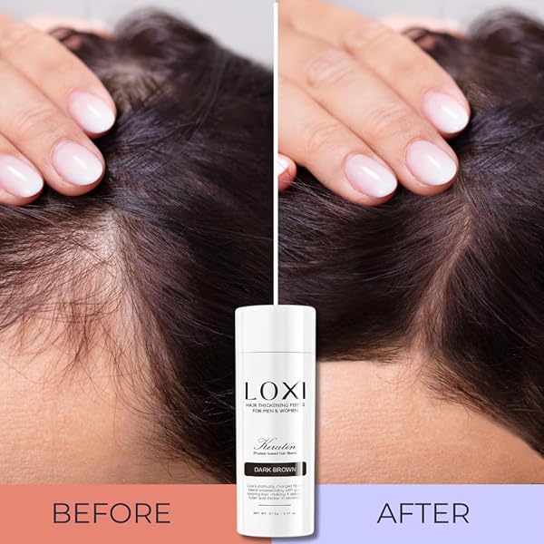 LOXI HAIR BUILDING FIBERS (27.5G) | FILL IN FINE, THINNING & BALDING HAIR FOR AN INSTANTLY THICKER & FULLER LOOK | PREMIUM KERATIN FORMULA | 5 SHADES FOR MEN & WOMEN (BLACK).