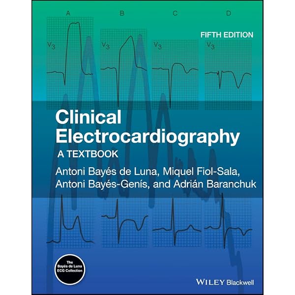 Amazon.com: Chou's Electrocardiography in Clinical Practice: Adult