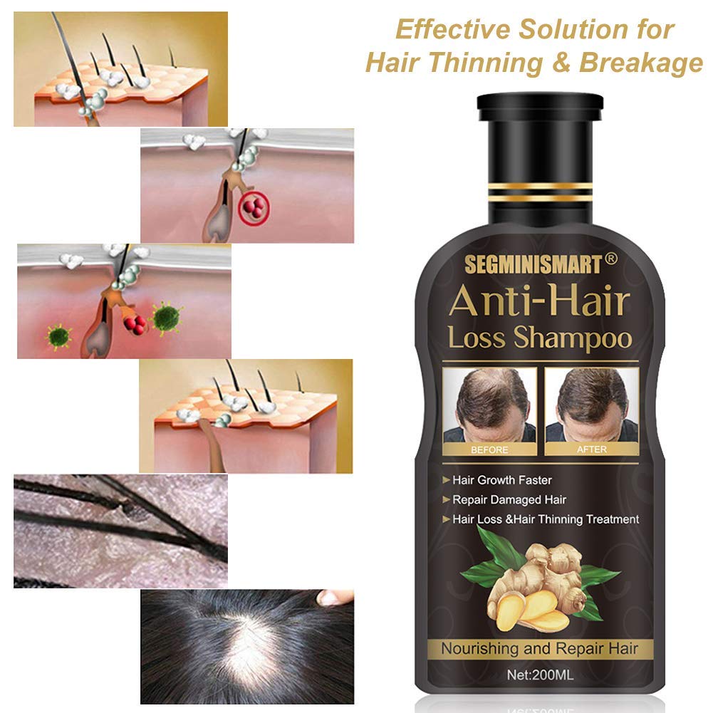 Hair Growth Shampoo,Anti-Hair Loss Shampoo,Hair Loss Shampoo,Hair Thickening Shampoo Helps Stop Hair Loss, Hair Growth for Stronger, Thicker, Longer Hair: Beauty