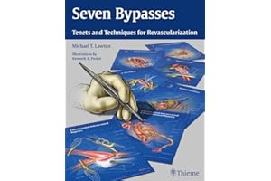 Seven Bypasses: Tenets and Techniques for Revascularization