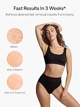 Ulike Air 3 IPL Hair Removal Device with Sapphire Ice Cooling Technology view 2