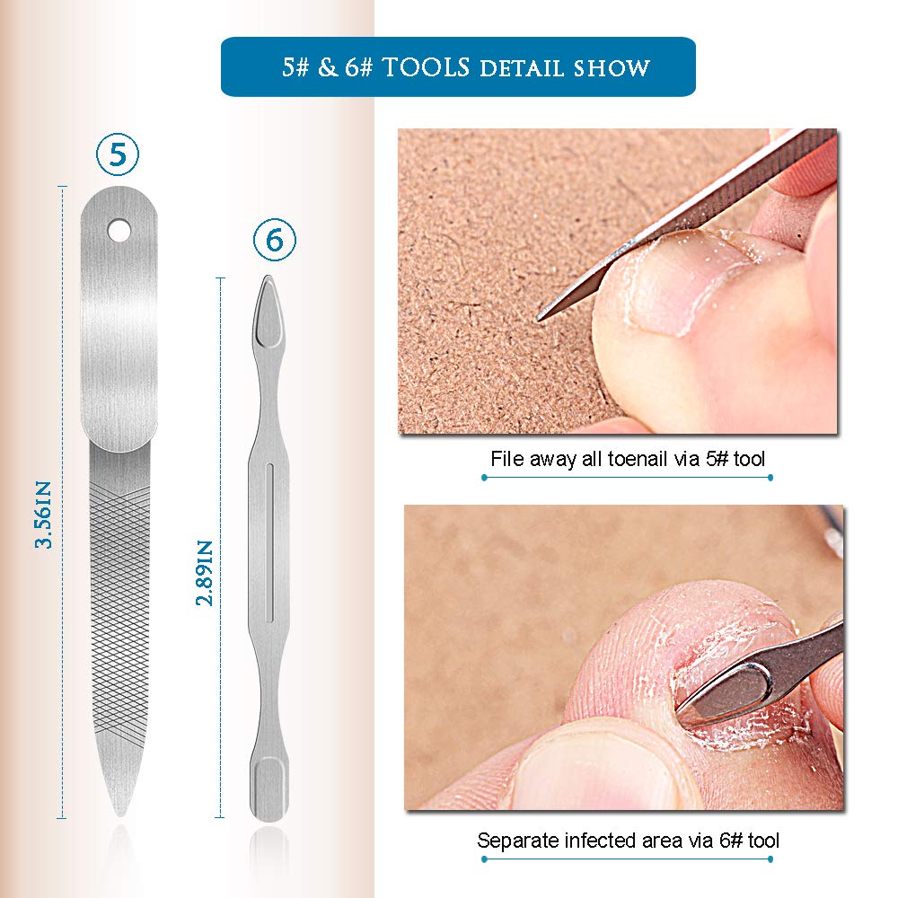 Premium 6PCS Ingrown Toenail Tools, Nail File and Lifter, Foot Nail Treatment Tool, Toe Nail Removal Clippers, Upgraded Stainless Steel, Professional Pedicure Tools, With Nail Cutter Trimmer: Beauty