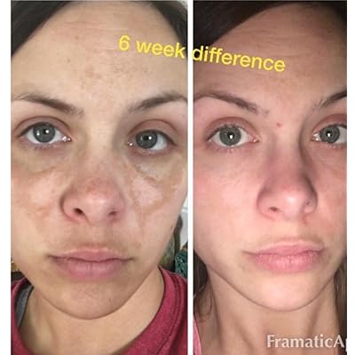 cicatricure for dark spots