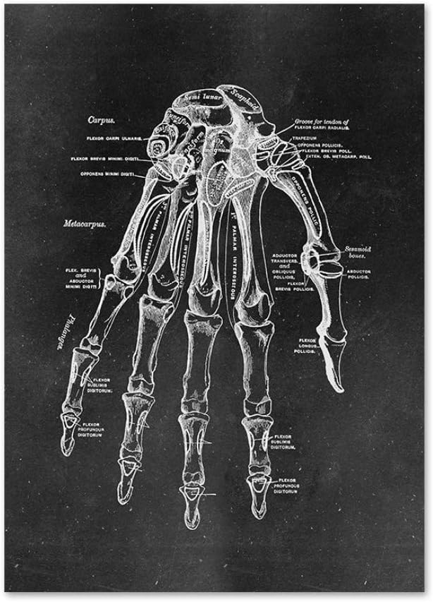 Amazon Com Print On Canvas Black White Hand Bone Anatomy Parsing Wall Art Canvas Painting Nordic Medicine Education Posters And Prints Wall Pictures For Doctor Office Living Room Decor No Frame 50 70cm Furniture Amazon Com Print On Canvas Black White Hand Bone Anatomy Parsing Wall Art Canvas Painting Nordic Medicine Education Posters And Prints Wall Pictures For Doctor Office Living Room Decor No Frame 50 70cm Furniture