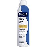 PanOxyl Acne Banishing Body Spray with 2% Salicylic Acid, Pimple Treatment Spray to Clear Stubborn Breakouts, 360-Degree Spray Nozzle, Skin-Brightening Niacinamide, Vitamin C, Witch Hazel, Aloe, 6 Oz