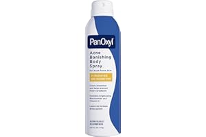 PanOxyl Acne Banishing Body Spray with 2% Salicylic Acid, Pimple Treatment Spray to Clear Stubborn Breakouts, 360-Degree Spray Nozzle, Skin-Brightening Niacinamide, Vitamin C, Witch Hazel, Aloe, 6 Oz
