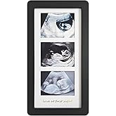 trlry Love at First Sight Ultrasound Picture Frames,Triple Ultrasound Picture Frames,Sonogram Picture Frame 3 Photos,Pregnancy Announcements (Black)